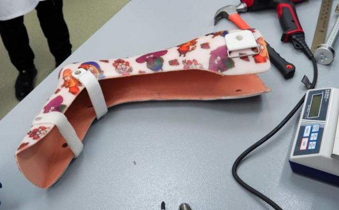 В Алматы открыли государственную лабораторию индивидуальных ортезов с 3D-технологиями